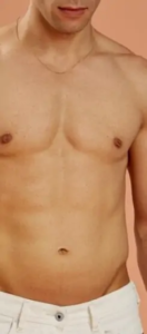 شفط الدهون في جدة,