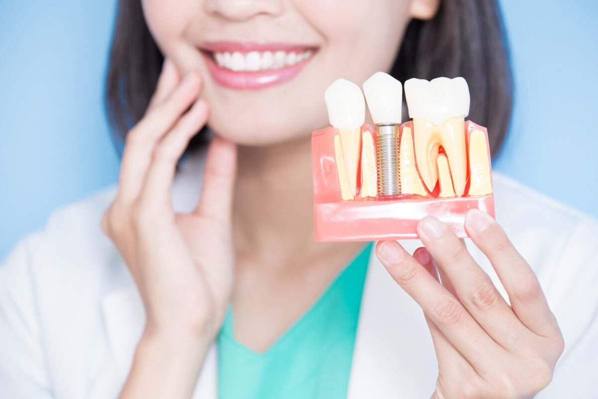 Affordable Dental Implants: Restore Your Smile with A Budget Friendly Option