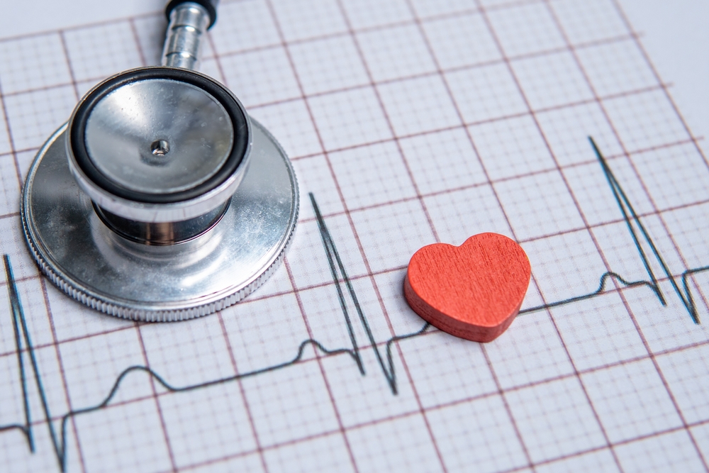 main causes and symptoms of sinus arrhythmia