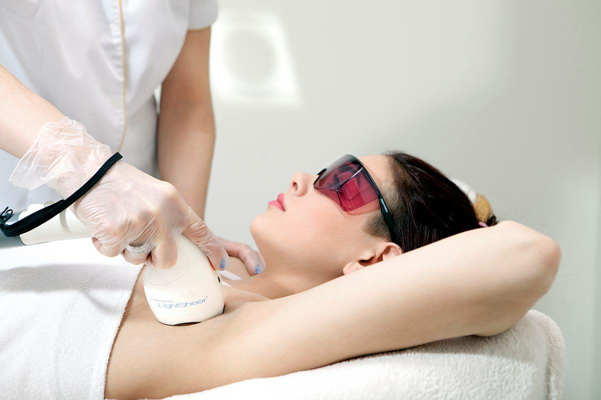 laser hair removal