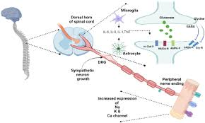 Mechanism of neuropathic pain