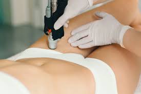 Brazilian laser hair removal