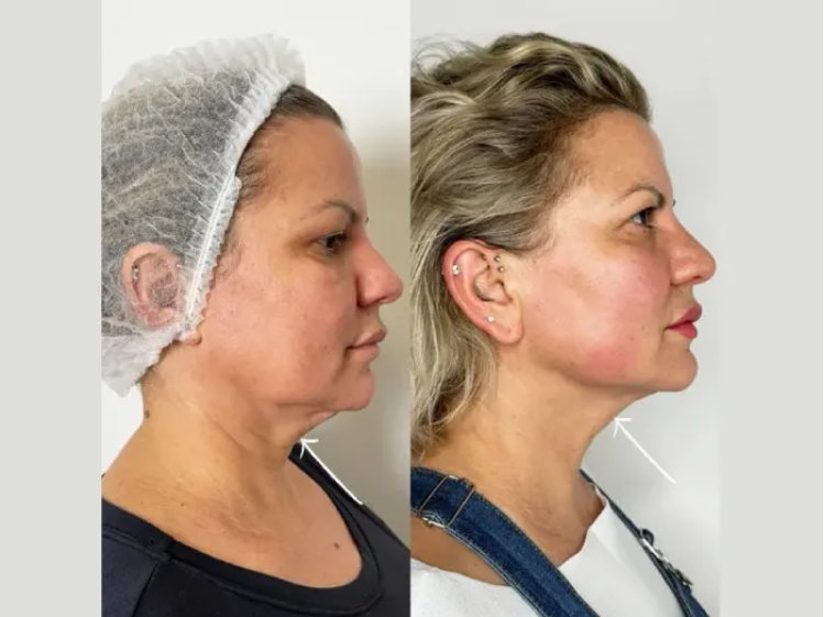 Best Doctors in Dubai for Celebrity Hair Treatments
