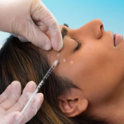 Botox Treatment