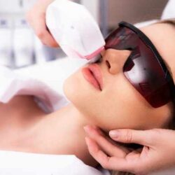 Laser Hair Removal