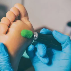 Quality Podiatry Care by Certified Podiatrists in Edinburgh