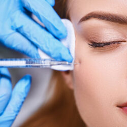 Natural results after Conshohocken Botox Injections for wrinkle reduction