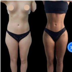 Celebrity Doctors Offering J-Plasma Skin Tightening in Dubai