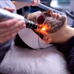 Best Carbon Laser Facial Treatment