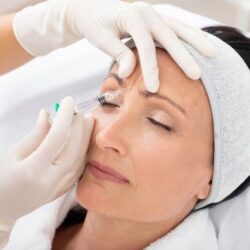 Botox forehead lines