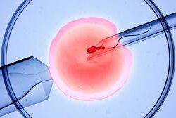 ivf in dubai
