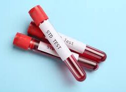 Affordable, discreet STD testing.