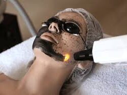 Exfoliates and refreshes skin tone