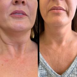 Best Aesthetic Clinics in dubai