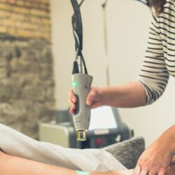 Laser Tattoo Removal