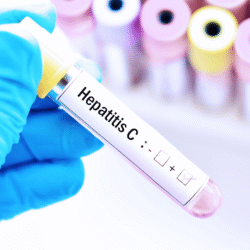 Quick blood test for hepatitis C
