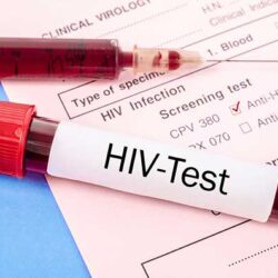 Reliable HIV screening