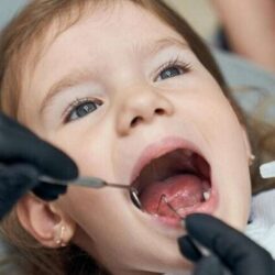 Child for Tooth Extraction