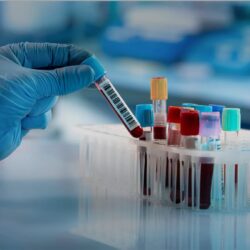 Can a Hepatitis C Test Detect Infection Early