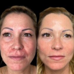 Best Aesthetic Clinics in dubai