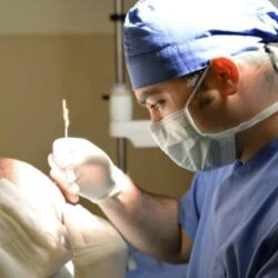 Hair Transplant in Islamabad