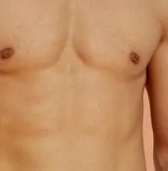 شفط الدهون في جدة,