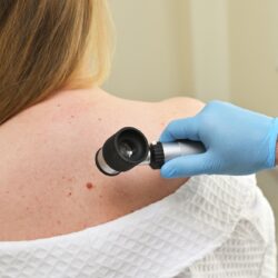 how skin check‑ups help to detect skin cancer