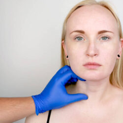 Kybella Treatment for Double Chin in Dubai